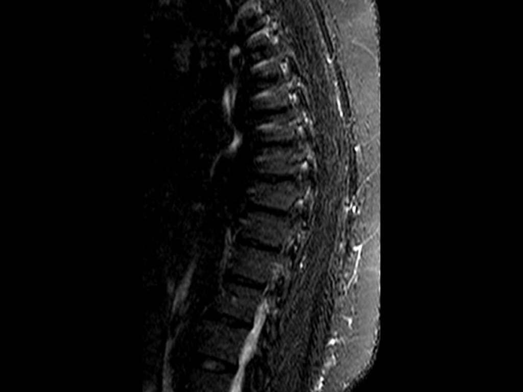 Example of the image in the dataset