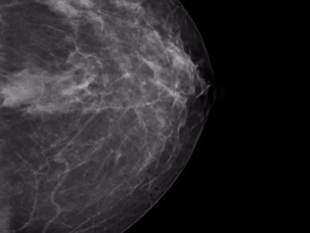 Mammography Segmentation Dataset