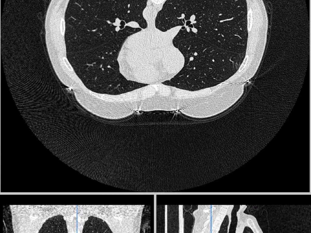 Chest CT Segmentation Dataset