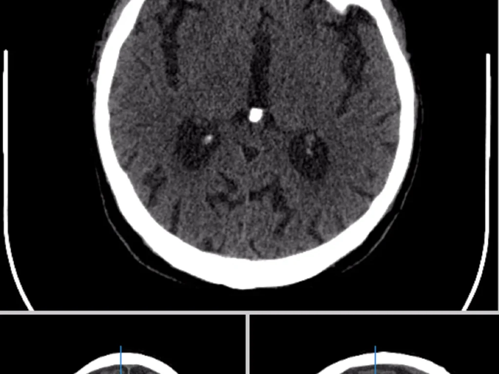 Brain CT Segmentation Dataset