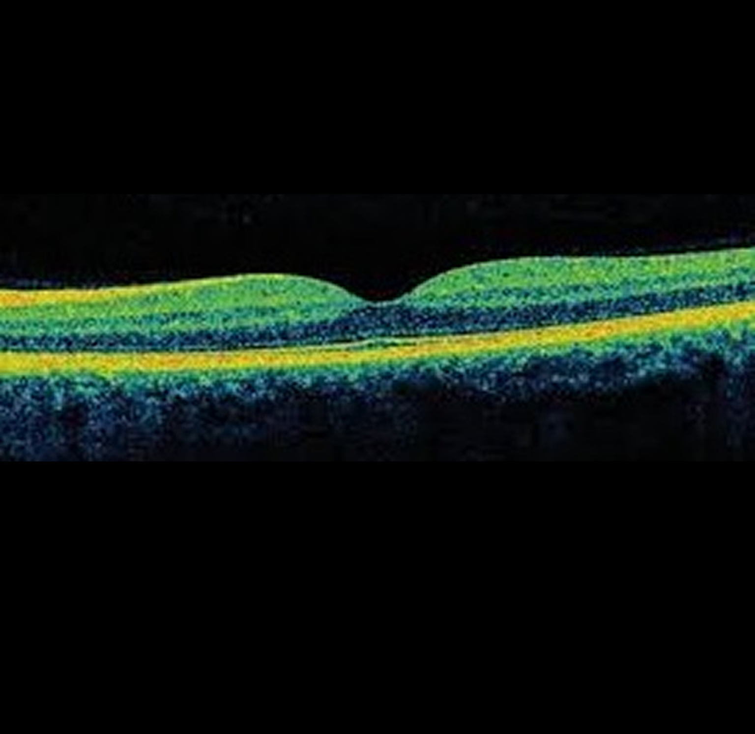 OCT Retinal Images Dataset - unidata.pro