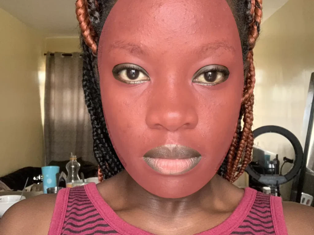 Facial Skin Condition Dataset
