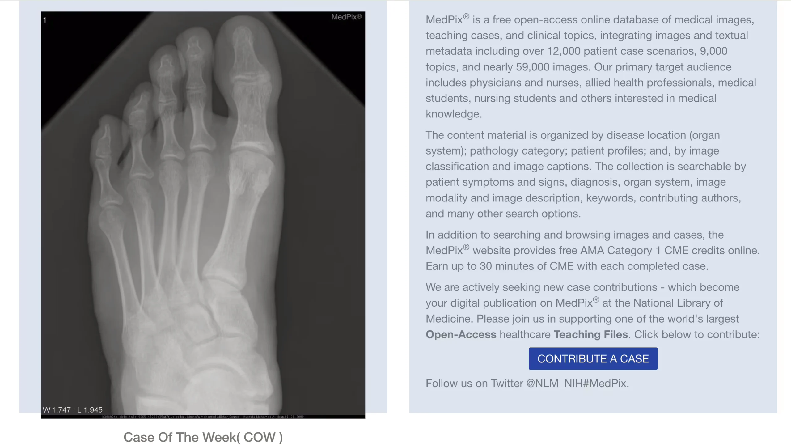 MedPix dataset