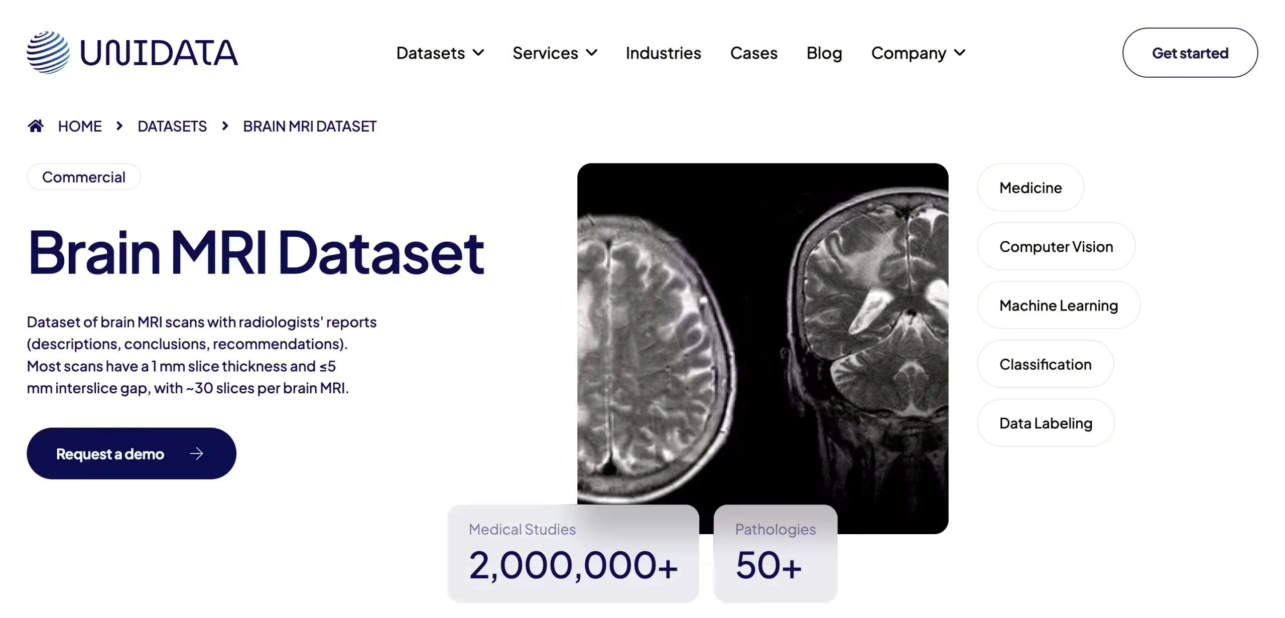 Unidata Brain MRI Collection
