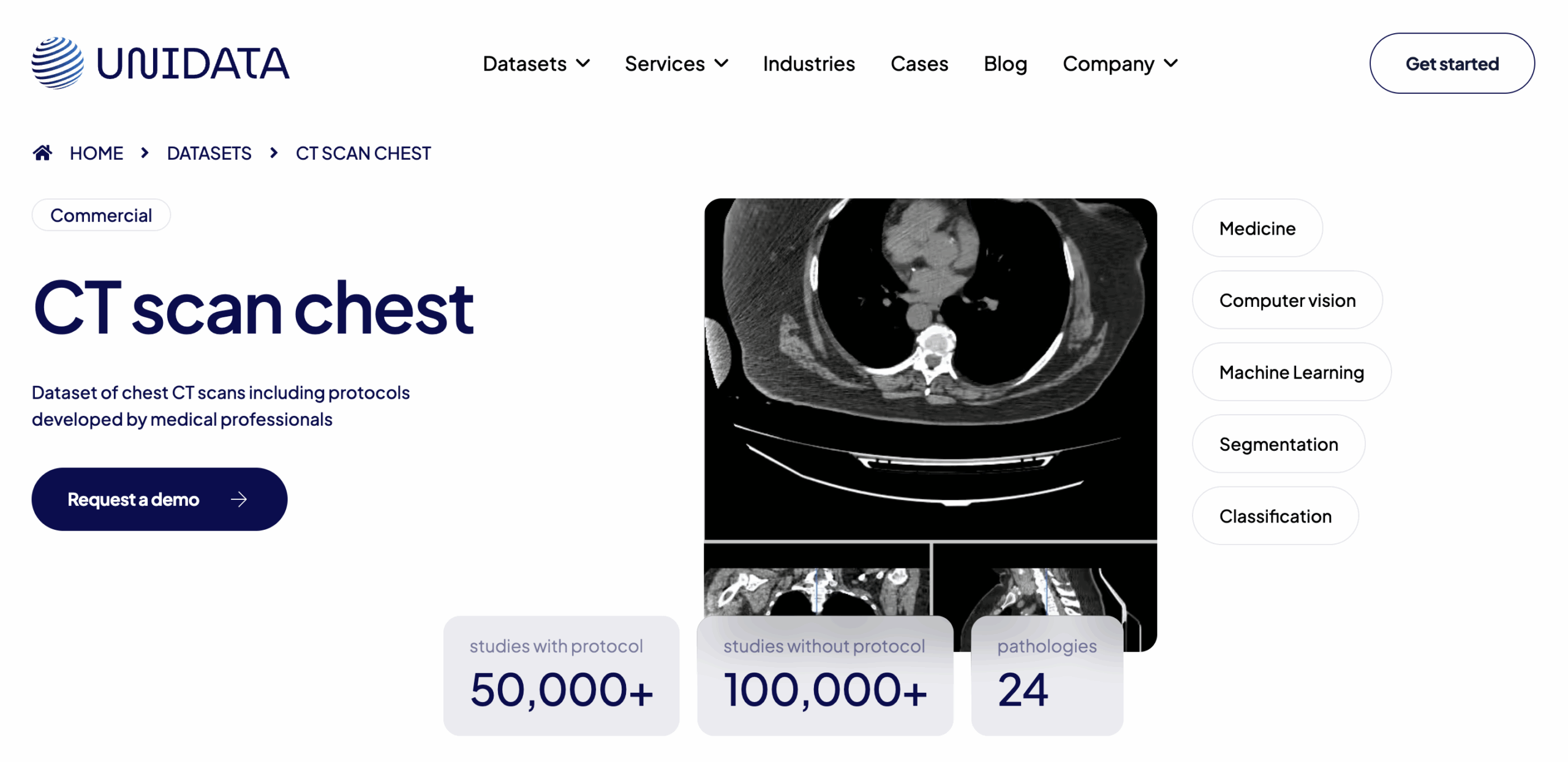Unidata Chest CT Collection