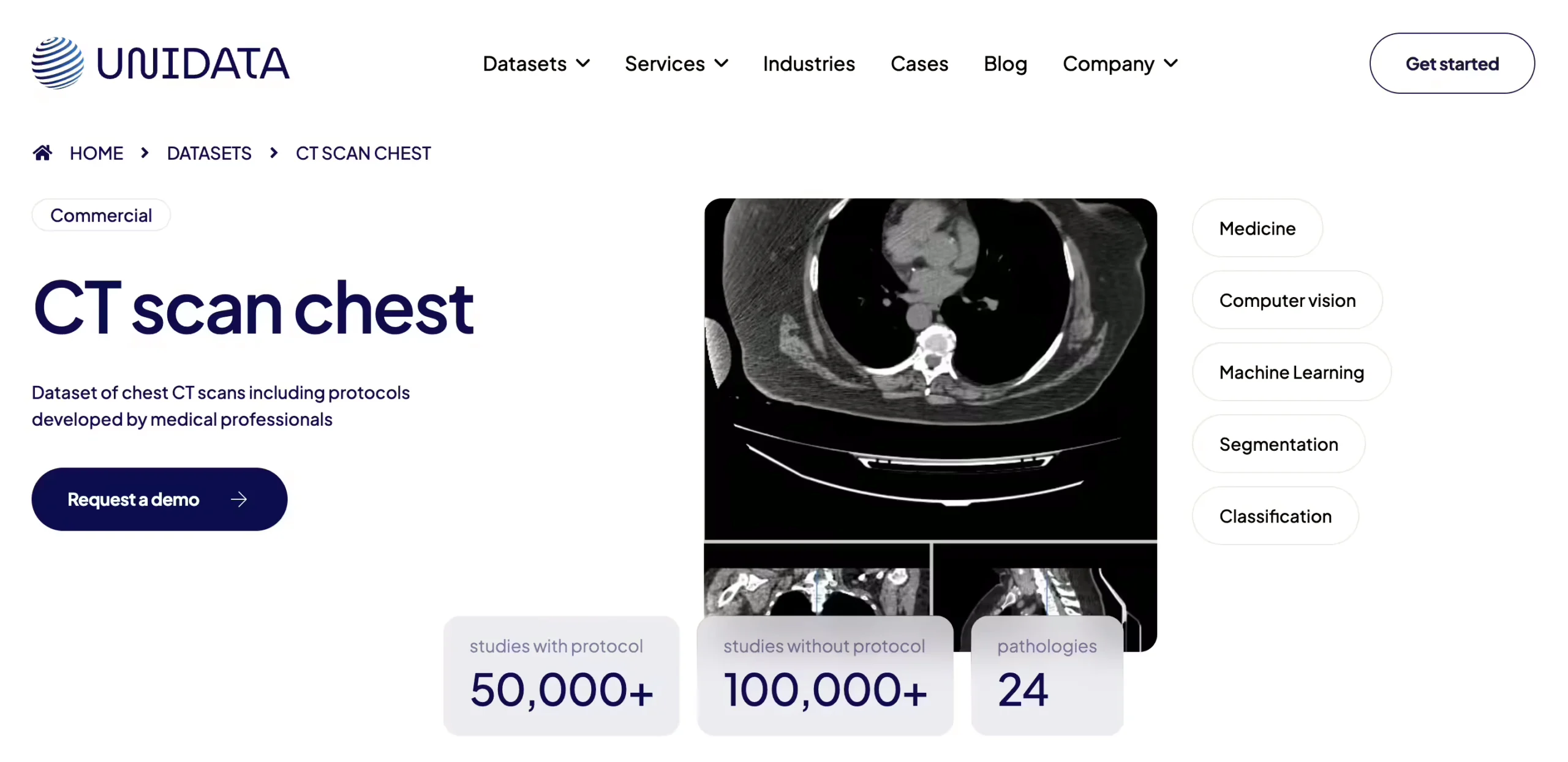 Unidata Chest CT Collection
