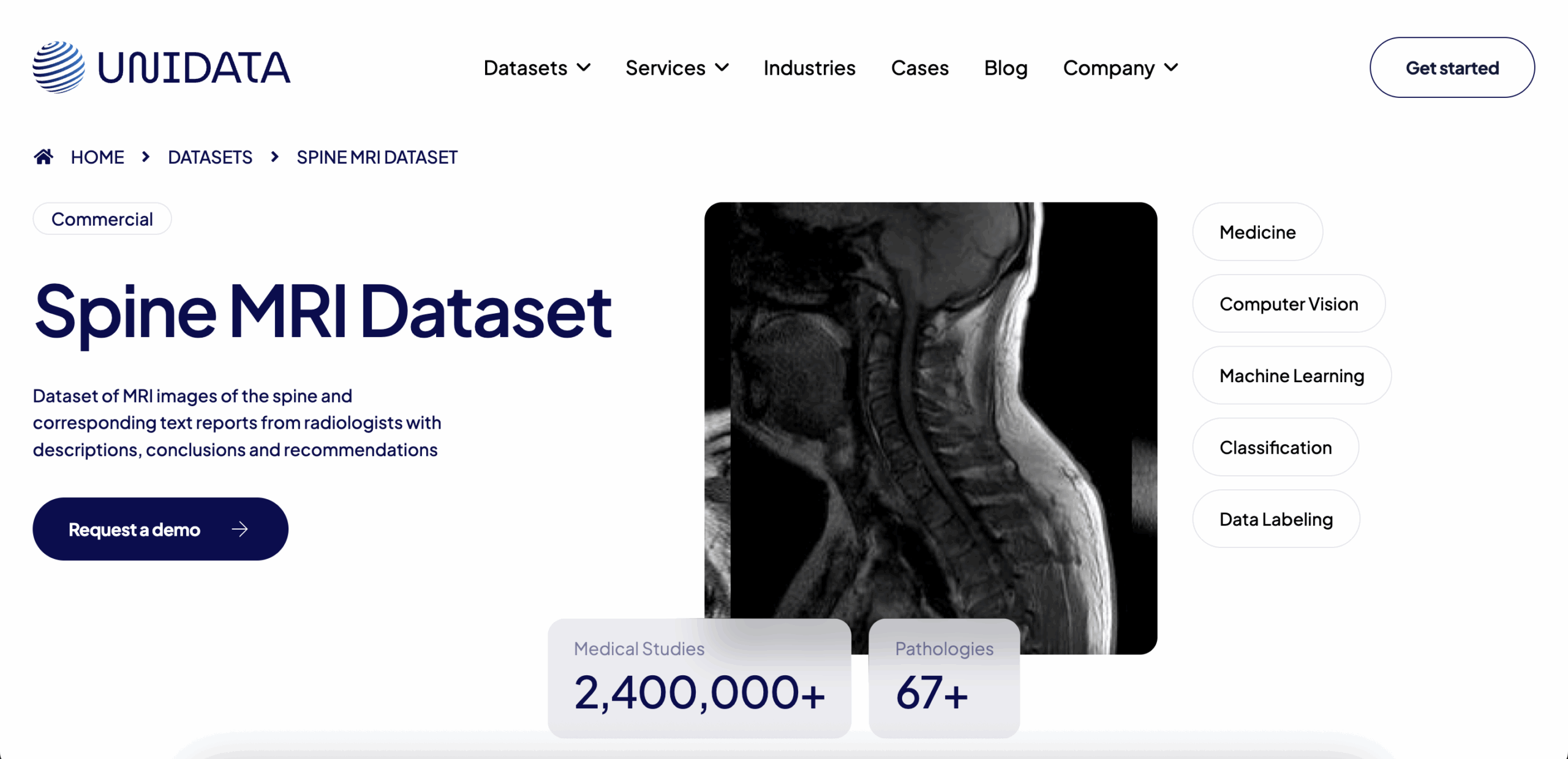 Unidata Spine MRI Collection