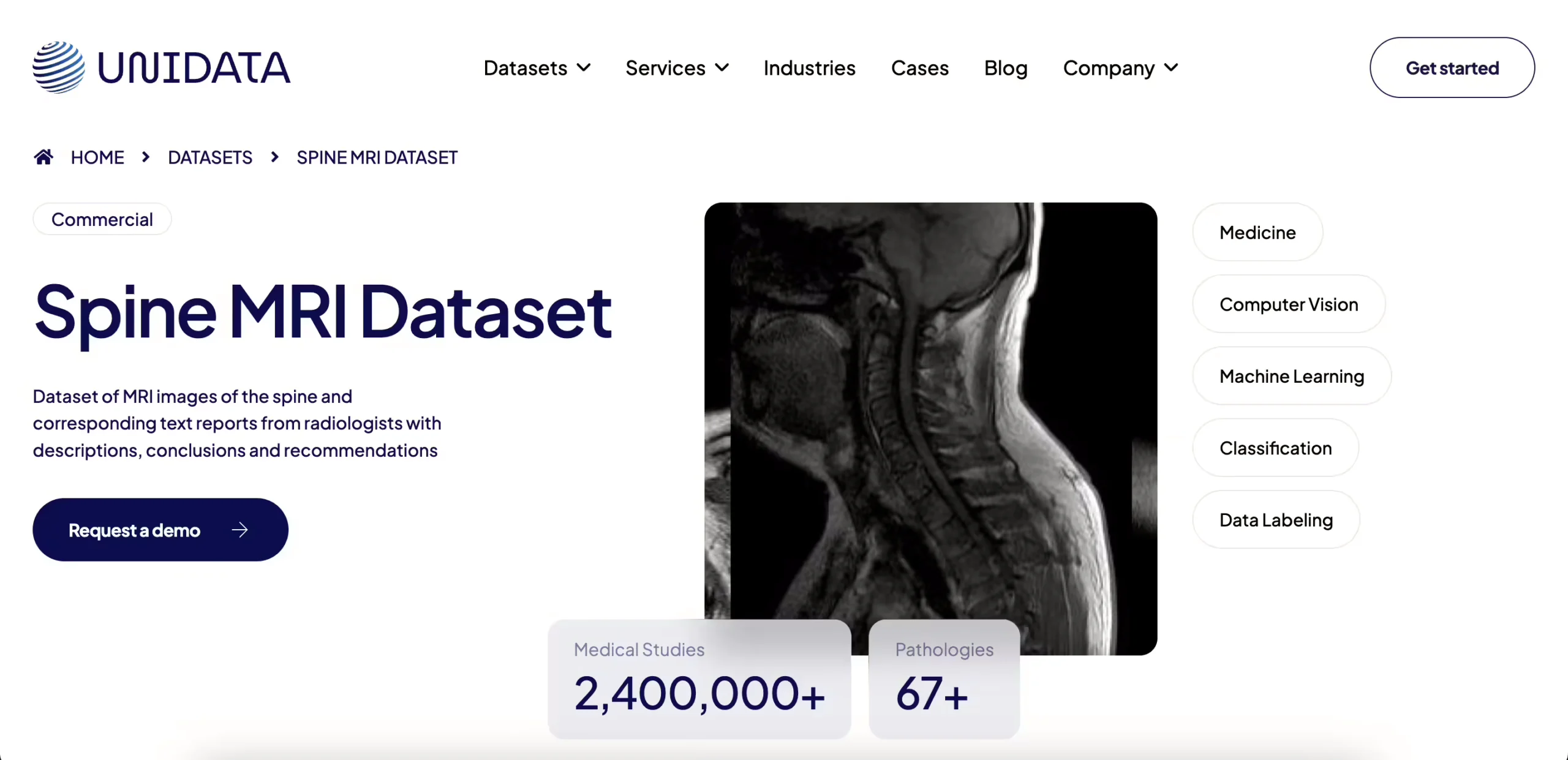 Unidata Spine MRI Collection