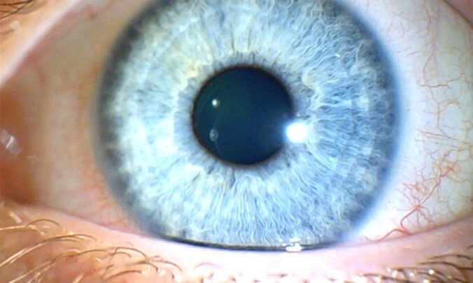 Human Iris Images Dataset