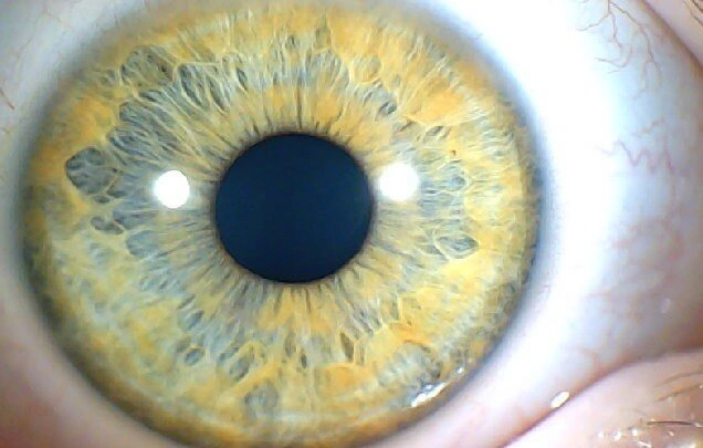 Human Iris Images Dataset